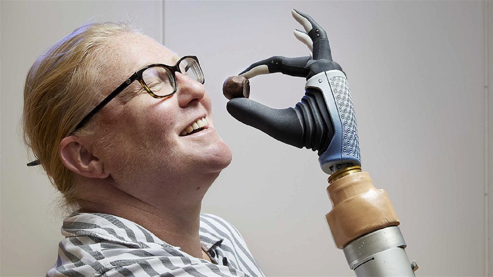Immagine di La mano bionica fatta in Italia è un successo globale