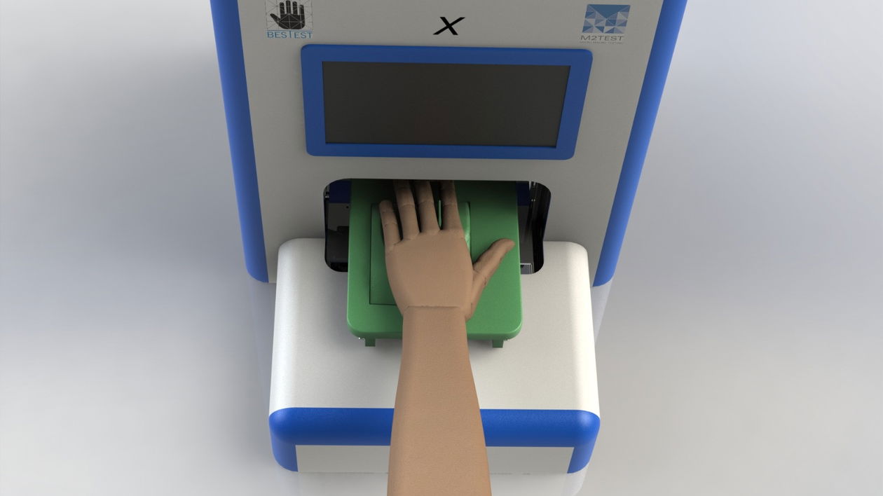 Immagine di Da M2 TEST un test per valutare la fragilità ossea con grande accuratezza