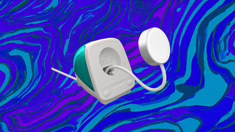 Immagine di Ecco a voi l’accessorio più figo di sempre per Apple Watch
