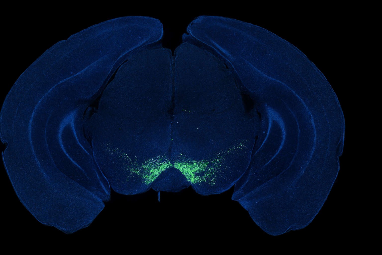 Parkinson, una scoperta cambia il ruolo della dopamina