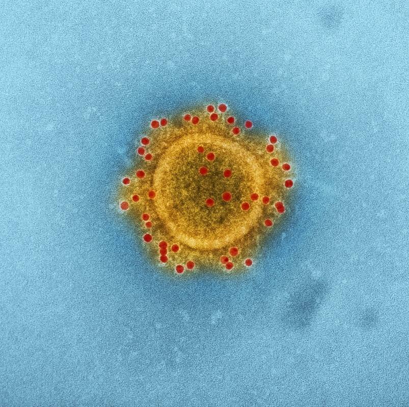 coronavirus-74976.jpg