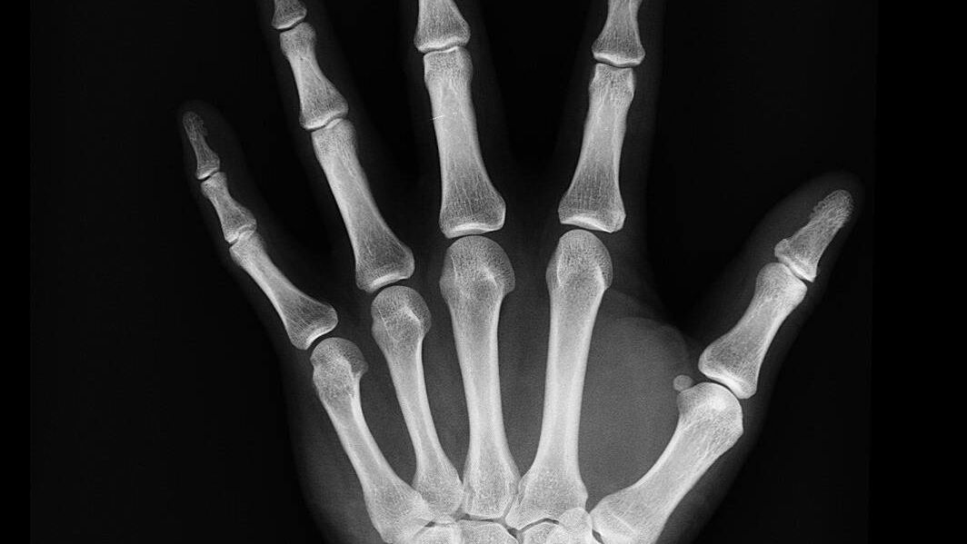 Immagine di M2Test, l'innovazione del BES Test