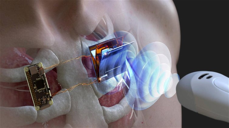 Immagine di Ultrasuoni per ricaricare dispositivi corporei