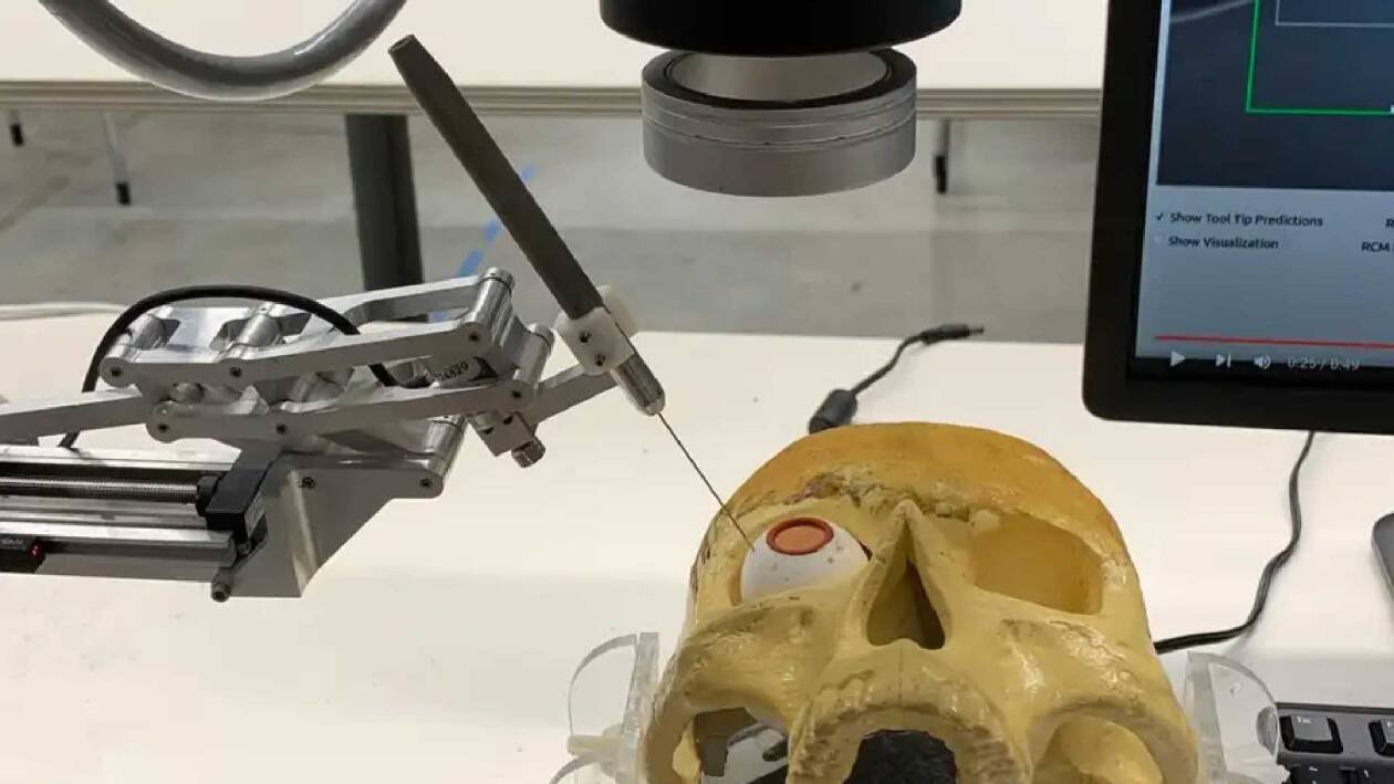 Immagine di I robot diventano più bravi dei chirurghi umani